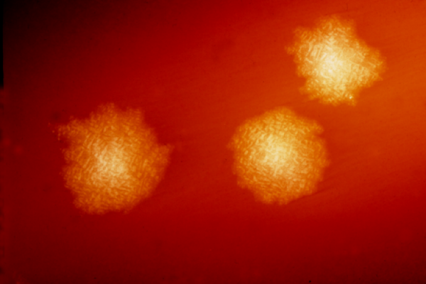 9271_clostridium_difficile_colonies_21628 (1).png